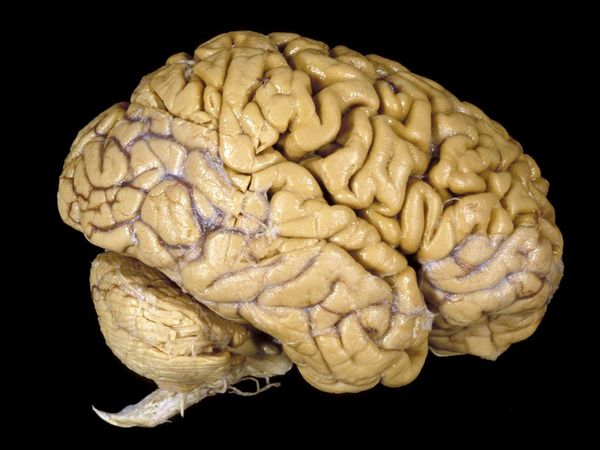 human-brain_1001_600x450.jpg