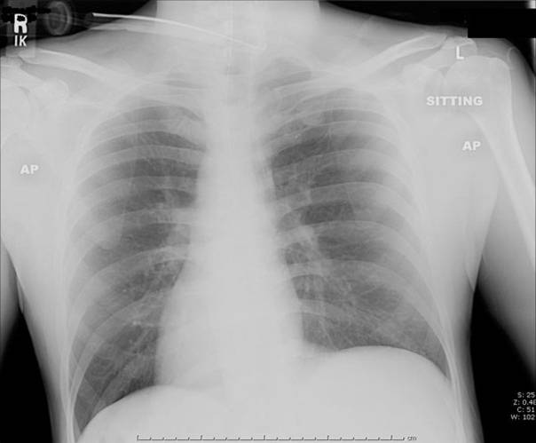 CHEST.jpg